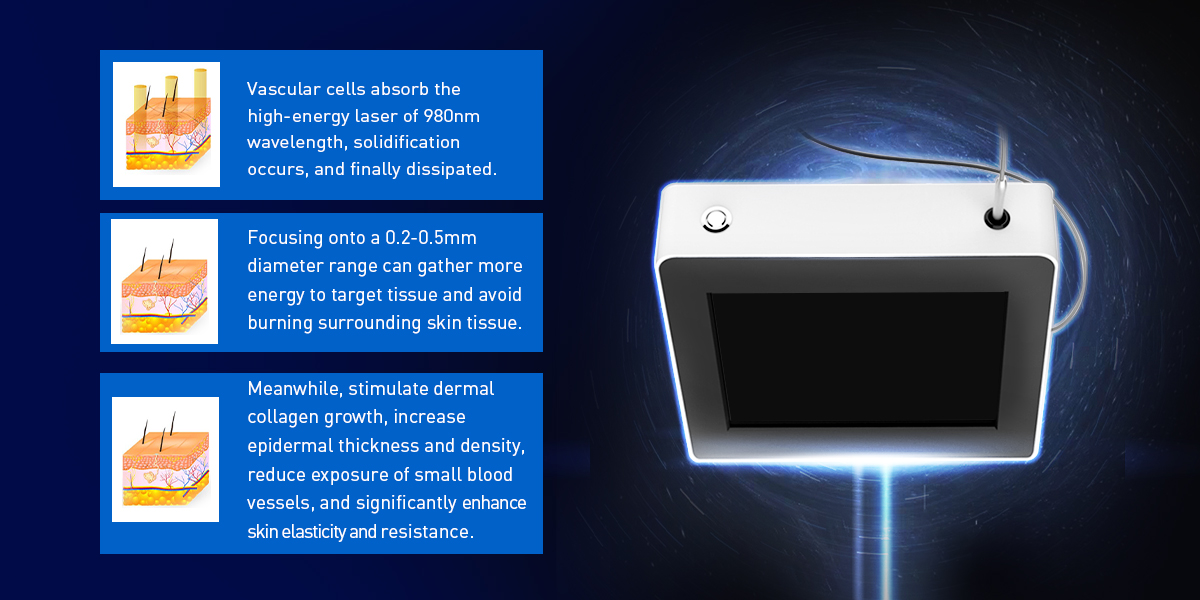 Machine laser à diode 980nm 