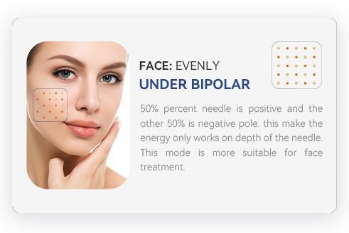 machine professionnelle de microneedling rf